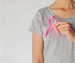 New switchable CAR-T therapy enters phase 1 trial for advanced breast cancer