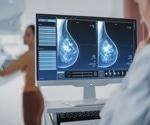 New technology tracks solid tumor treatment response through blood samples