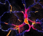 Researchers discover new trigger for mitophagy