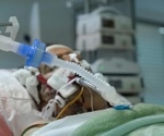 Dementia survival rates improve across multiple countries, study shows