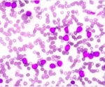 Maybe it’s not just aging. Maybe it’s anemia.
