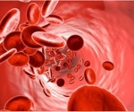 Maybe it’s not just aging. Maybe it’s anemia.