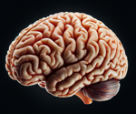 New insights into a mysterious type of amnesia