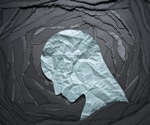 Study: Mental health providers often miss bulimia diagnosis