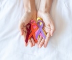 Combination of two cancer drugs could treat the most common form of dementia