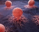 Blood-based tests show promise for colorectal cancer screening but follow-up challenges persist