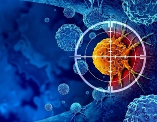 New national guidelines for anal cancer prevention in HIV patients based on UCSF research
