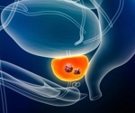 Indevus announces agreement with Pliva for overactive bladder treatment drug