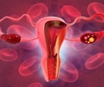 NIH spearheads study to test at-home screening for HPV and cervical cancer
