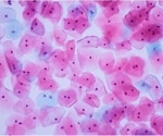 Multilevel interventions improve overall rate of HPV vaccinations
