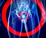 Rethinking prostate cancer risk in GG1 diagnoses