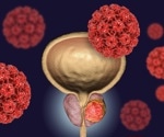 New research sheds light on prostate cancer resistance mechanisms