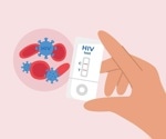 Researchers develop new model to tackle patients with cryptosporidiosis-HIV co-infection