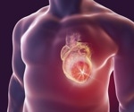 Walnuts prevent heart disease