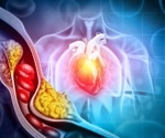 Nighttime avocado snack may support heart health in prediabetic adults