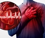 Most Americans oppose fast food sales in hospitals