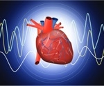 Stenting improves long term outcomes in CTO PCI patients