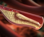 UK Biobank completes world's largest whole-body imaging project