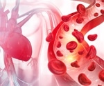 UK Biobank completes world's largest whole-body imaging project