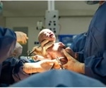 A brain-dead pregnant woman was kept alive in Georgia. It’s unclear if state law required it.