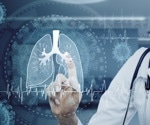 AI algorithm identifies one-third of missed breast cancers in DBT screenings