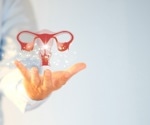 UCSF research maps over 600 conditions linked to endometriosis