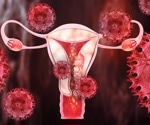 New menstrual blood test detects endometriosis with five times greater sensitivity