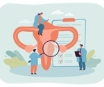UCSF research maps over 600 conditions linked to endometriosis