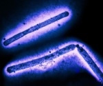 AI reveals how H5N1 virus is evolving to evade human immunity