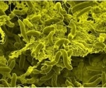 Improving WASH access is key to ending cholera in vulnerable countries by 2030