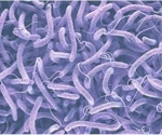 Study highlights the importance of clean water and sanitation in controlling endemic cholera