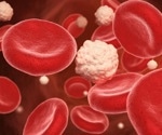 New approach preserves insulin-producing cells in diabetes model