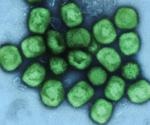 Tecovirimat monotherapy found ineffective for treating clade II mpox in NIH-sponsored trial
