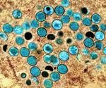 Blood viral load predicts severity of mpox symptoms