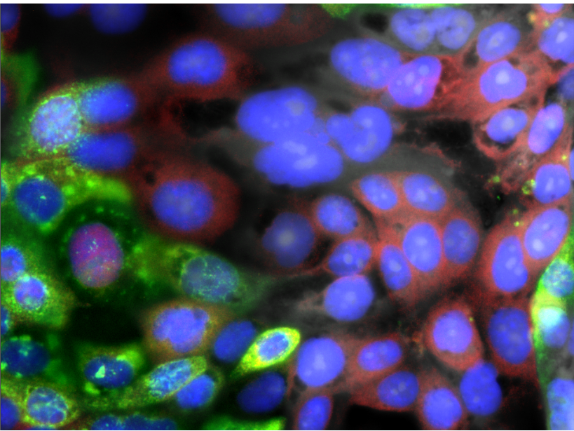 Human airway cells; with SARS-CoV-2 in green, innate immune response in red, and nucleus in blue Human airway cells; with SARS-CoV-2 in green, innate immune response in red, and nucleus in blue